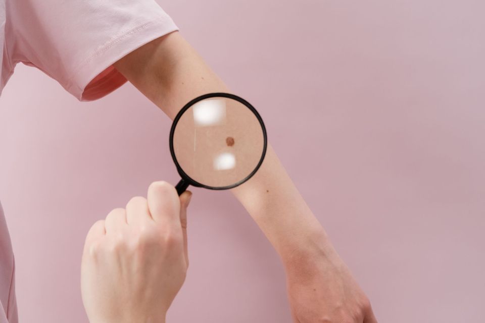 Mão segurando uma lupa sobre o antebraço de uma pessoa, em fundo rosa claro
