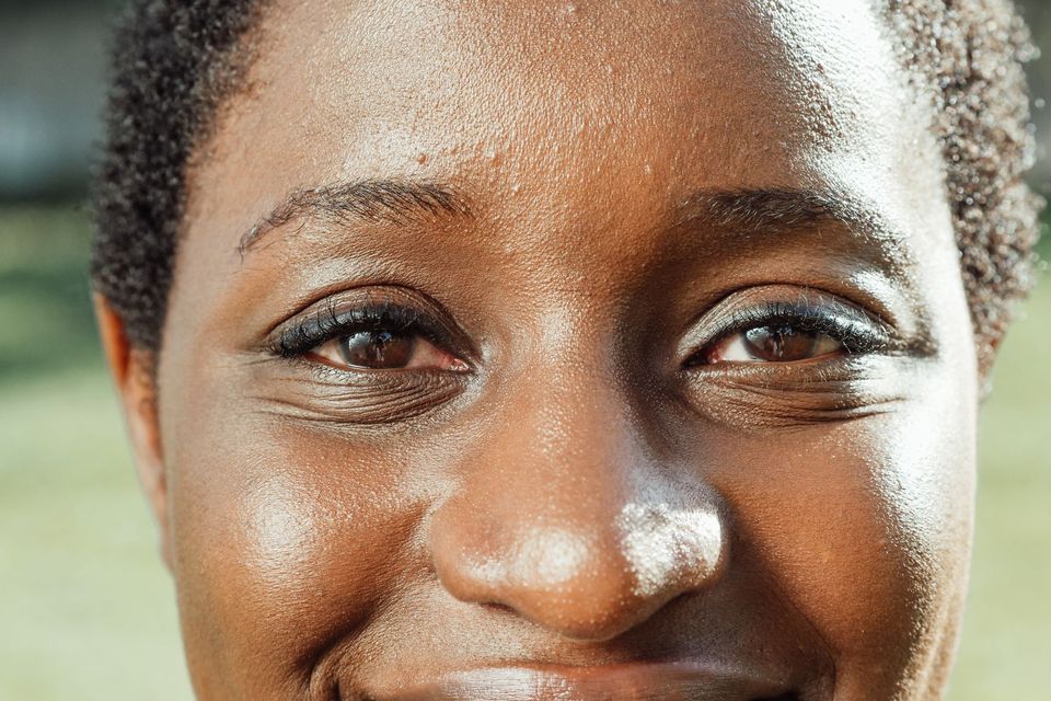 Close do rosto de uma mulher sorrindo, mostrando a região dos olhos e a pele ao redor